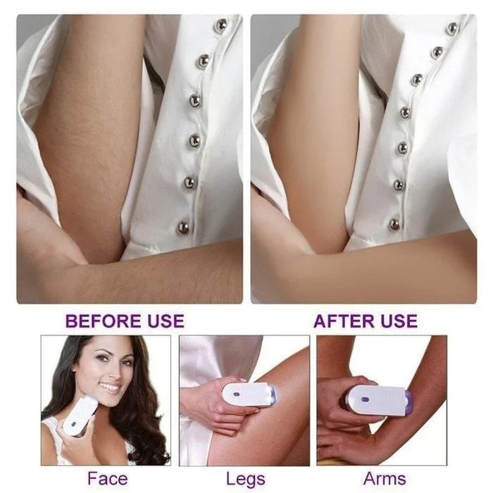 New Laser Hair Remover Blue Light Induction Ladies Shaver